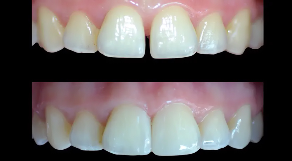 Dentısts Close Gaps