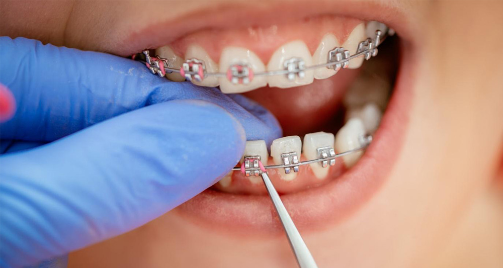 quality orthodontic treatment