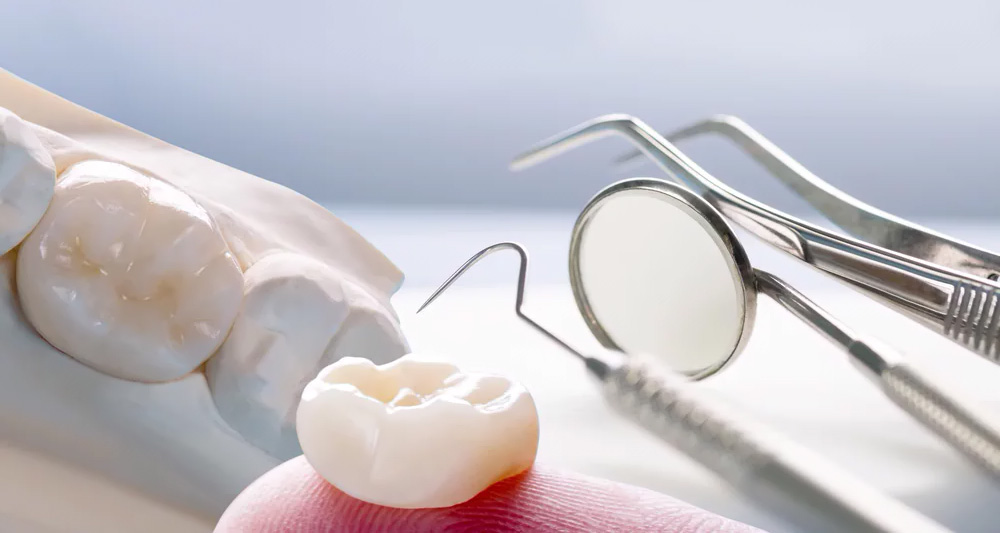 Which Dental Crown Material is Best?